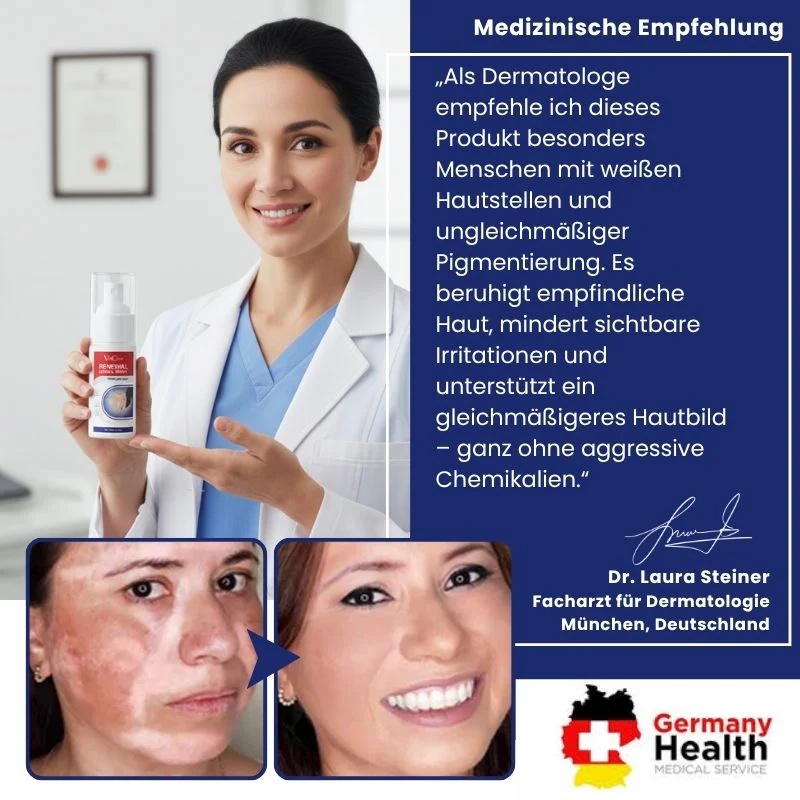 VitiClear™ | Unterstützt 3× schnellere Repigmentierung – sichtbare Ergebnisse in 2 Wochen! - Image 5
