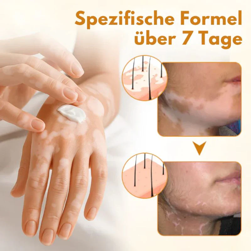 VitiClear™ | Bienengift Vitiligo Creme - Image 6