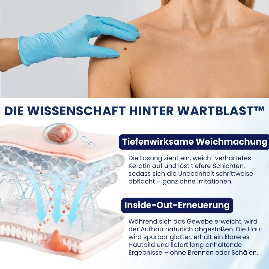WartBlast™ | Warzen- und Hühneraugen-Entfernungsflüssigkeit - Image 3