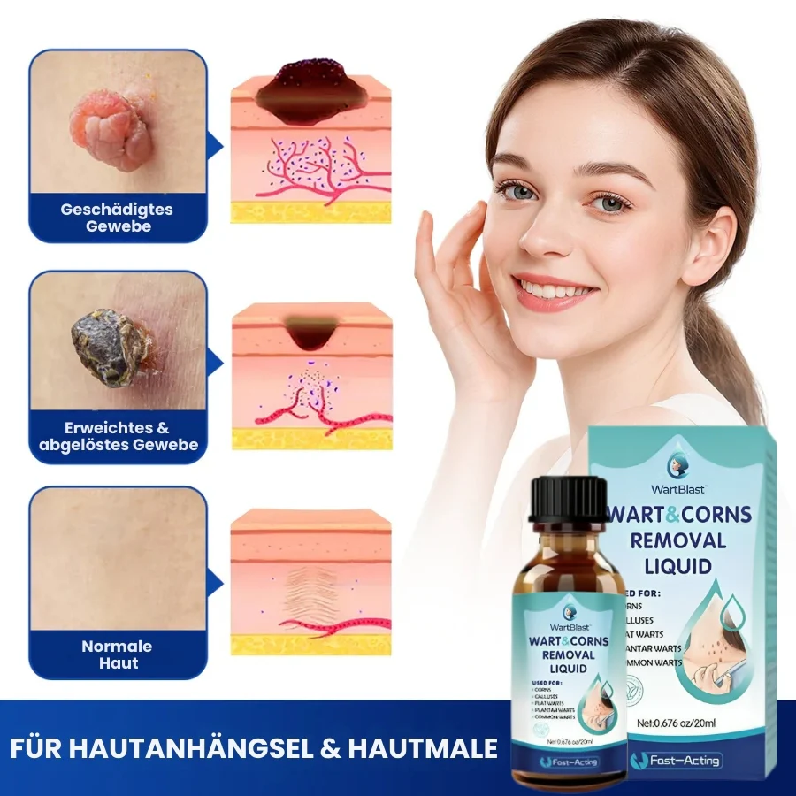 WartBlast™ | Warzen- und Hühneraugen-Entfernungsflüssigkeit - Image 5