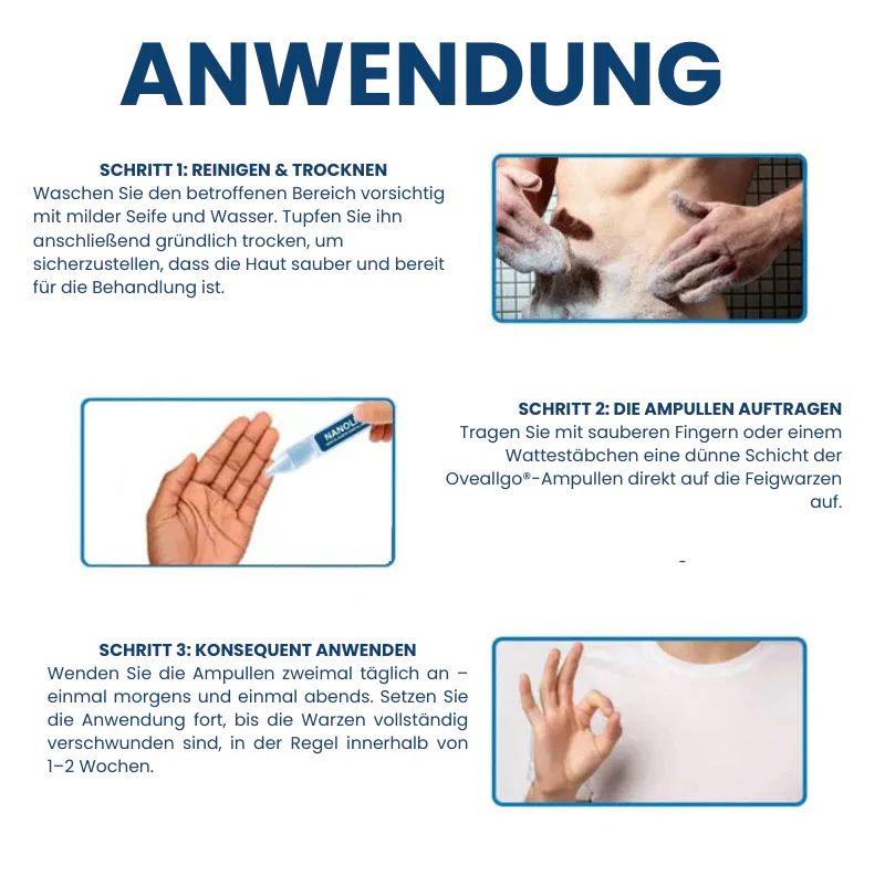 WartEase™ | HPV-Ampullen zur Entfernung von Genitalwarzen - Image 3