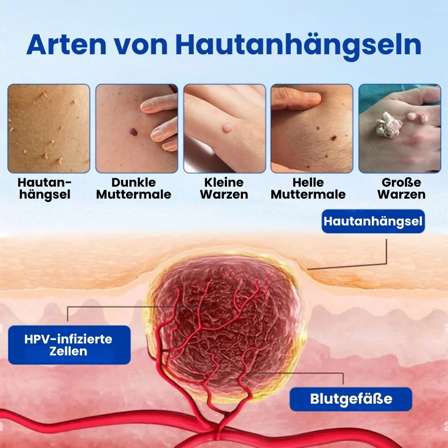 WartFix™ | Warzenentferner-Salbe - Image 5