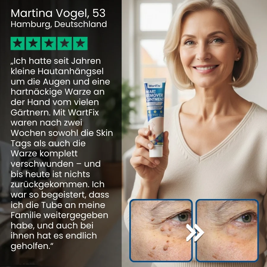 WartFix™ | Warzenentferner-Salbe - Image 6