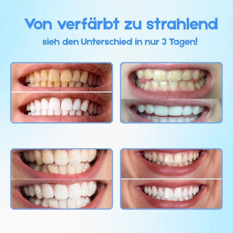 WeißGlanz™ | Zahnaufhellungsstift - Image 5