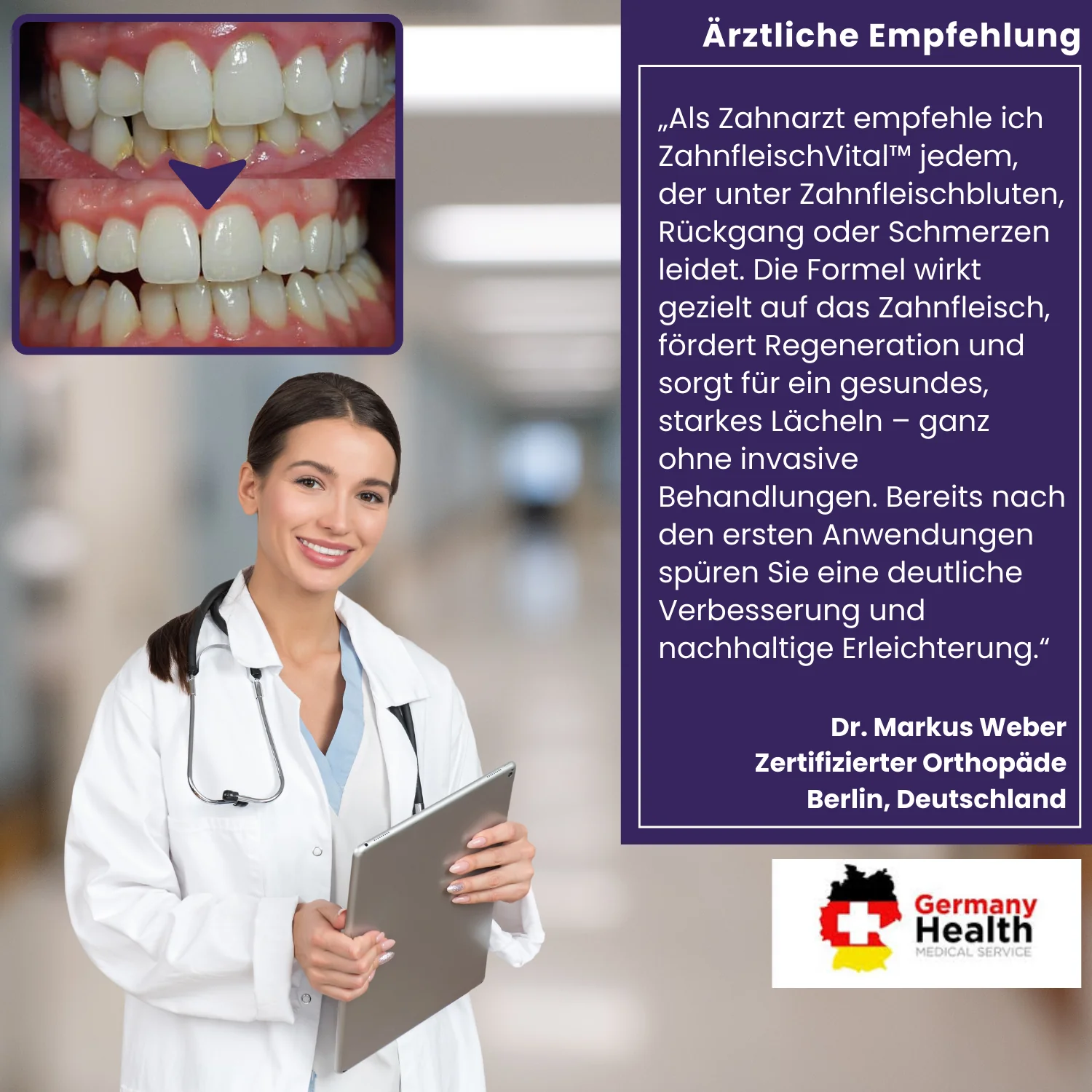 ZahnfleischVital™ | Baut zurückgehendes Zahnfleisch! - Image 2